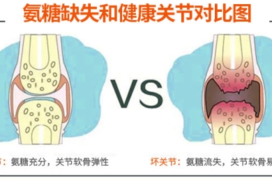 健力多氨糖软骨素长期吃吗？会有副作用吗？