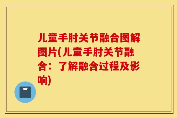 儿童手肘关节融合图解图片(儿童手肘关节融合：了解融合过程及影响)