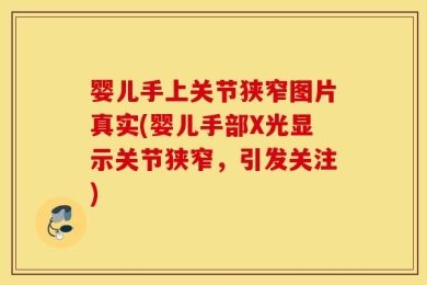 婴儿手上关节狭窄图片真实(婴儿手部X光显示关节狭窄，引发关注)