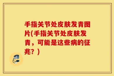 手指关节处皮肤发青图片(手指关节处皮肤发青，可能是这些病的征兆？)