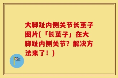 大脚趾内侧关节长茧子图片(「长茧子」在大脚趾内侧关节？解决方法来了！)