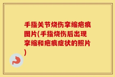 手指关节烧伤挛缩疤痕图片(手指烧伤后出现挛缩和疤痕症状的照片)