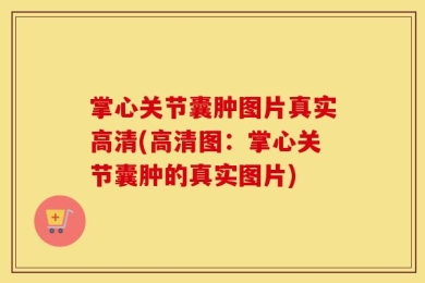 掌心关节囊肿图片真实高清(高清图：掌心关节囊肿的真实图片)
