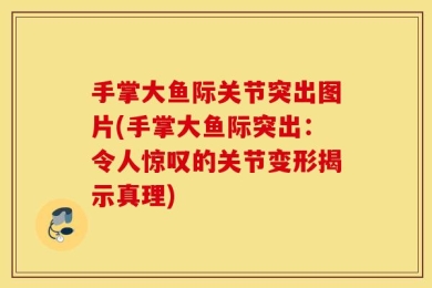 手掌大鱼际关节突出图片(手掌大鱼际突出：令人惊叹的关节变形揭示真理)