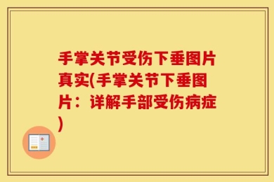 手掌关节受伤下垂图片真实(手掌关节下垂图片：详解手部受伤病症)