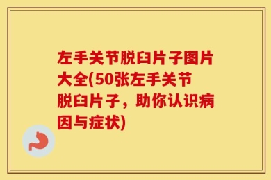 左手关节脱臼片子图片大全(50张左手关节脱臼片子，助你认识病因与症状)