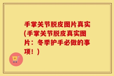手掌关节脱皮图片真实(手掌关节脱皮真实图片：冬季护手必做的事项！)