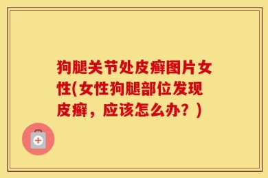 狗腿关节处皮癣图片女性(女性狗腿部位发现皮癣，应该怎么办？)