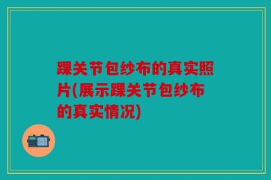 踝关节包纱布的真实照片(展示踝关节包纱布的真实情况)