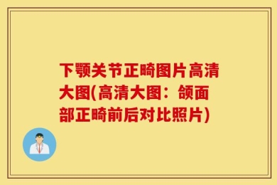 下颚关节正畸图片高清大图(高清大图：颌面部正畸前后对比照片)