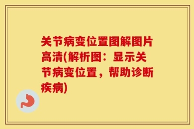 关节病变位置图解图片高清(解析图：显示关节病变位置，帮助诊断疾病)