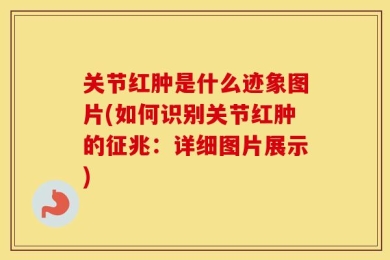 关节红肿是什么迹象图片(如何识别关节红肿的征兆：详细图片展示)