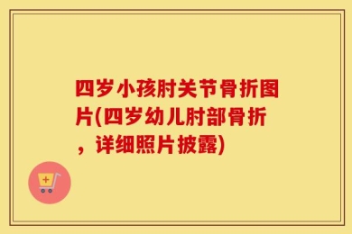 四岁小孩肘关节骨折图片(四岁幼儿肘部骨折，详细照片披露)