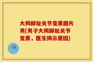 大拇脚趾关节变黑图片男(男子大拇脚趾关节变黑，医生揭示原因)