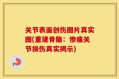 关节表面创伤图片真实图(重建骨骼：惨痛关节损伤真实揭示)