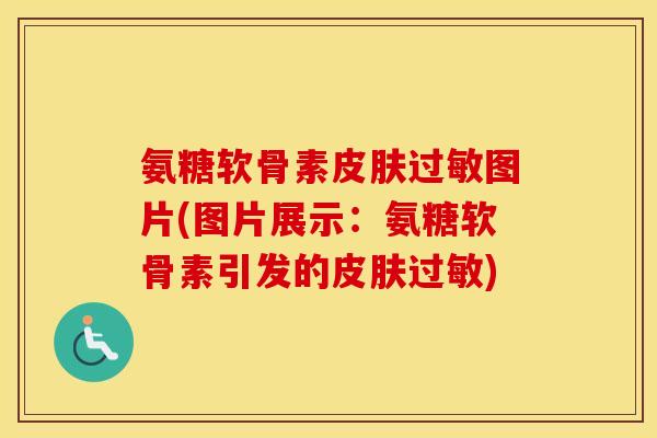 氨糖软骨素图片(图片展示:氨糖软骨素引发的) 氨糖软骨素图片(图片展示:氨糖软骨素引发的)
