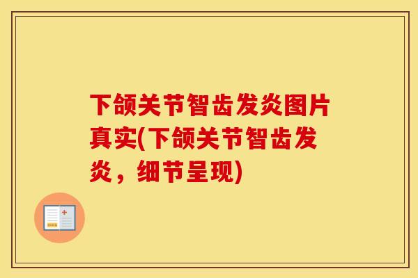 下颌关节智齿发炎图片真实(下颌关节智齿发炎，细节呈现)