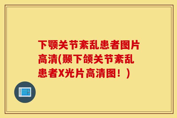 下颚关节紊乱患者图片高清(颞下颌关节紊乱患者X光片高清图!) 下颚关节紊乱患者图片高清(颞下颌关节紊乱患者X光片高清图!)