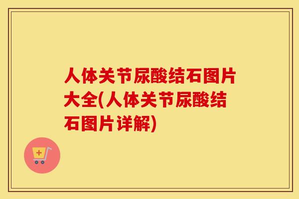人体关节尿酸结石图片大全(人体关节尿酸结石图片详解)