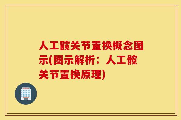 人工髋关节置换概念图示(图示解析:人工髋关节置换原理) 人工髋关节置换概念图示(图示解析:人工髋关节置换原理)