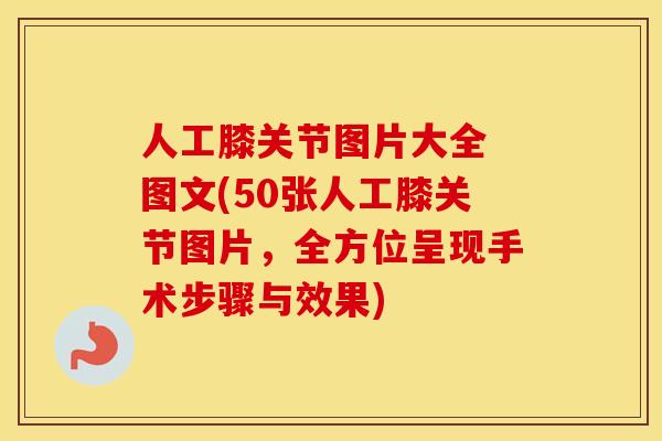 人工膝关节图片大全 图文(50张人工膝关节图片,全方位呈现手术步骤与效果) 人工膝关节图片大全 图文(50张人工膝关节图片,全方位呈现手术步骤与效果)