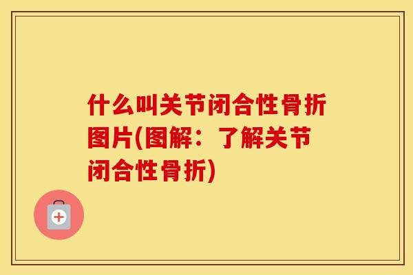 什么叫关节闭合性图片(图解:了解关节闭合性) 什么叫关节闭合性图片(图解:了解关节闭合性)