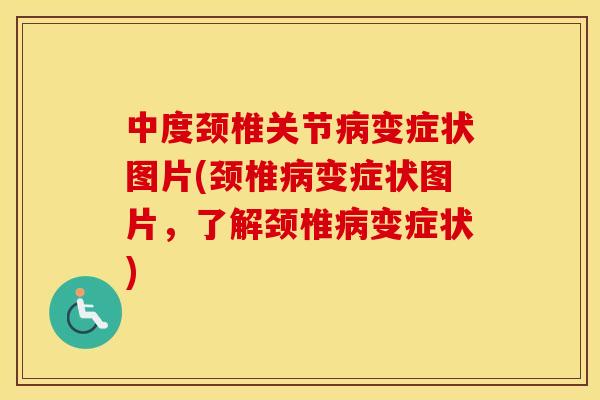 中度颈椎关节变症状图片(颈椎变症状图片,了解颈椎变症状) 中度颈椎关节变症状图片(颈椎变症状图片,了解颈椎变症状)