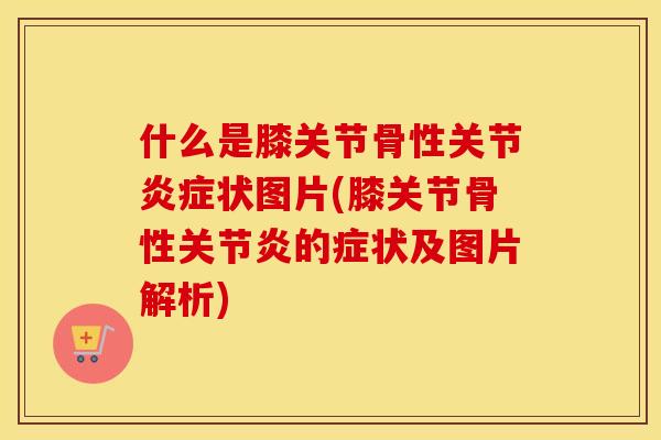 什么是膝关节骨性关节状图片(膝关节骨性的症状及图片解析)