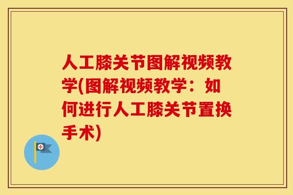 人工膝关节图解视频教学(图解视频教学:如何进行人工膝关节置换手术) 人工膝关节图解视频教学(图解视频教学:如何进行人工膝关节置换手术)