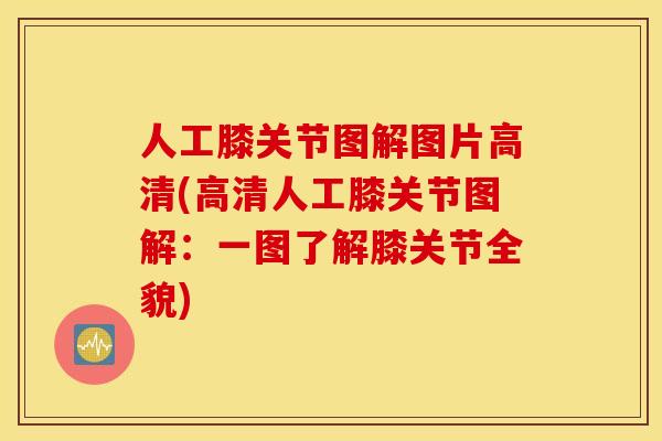人工膝关节图解图片高清(高清人工膝关节图解：一图了解膝关节全貌)