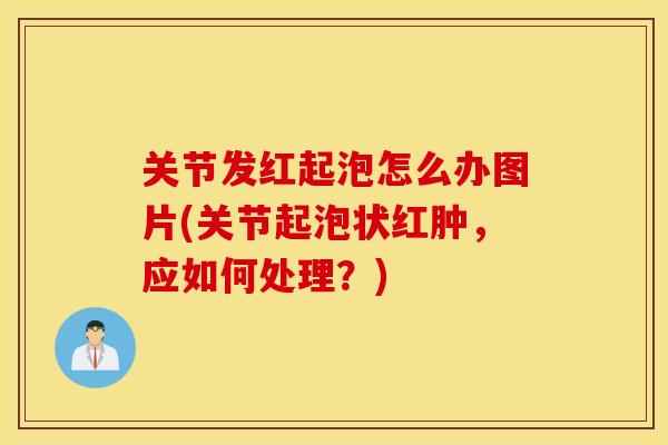 关节发红起泡怎么办图片(关节起泡状红肿，应如何处理？)