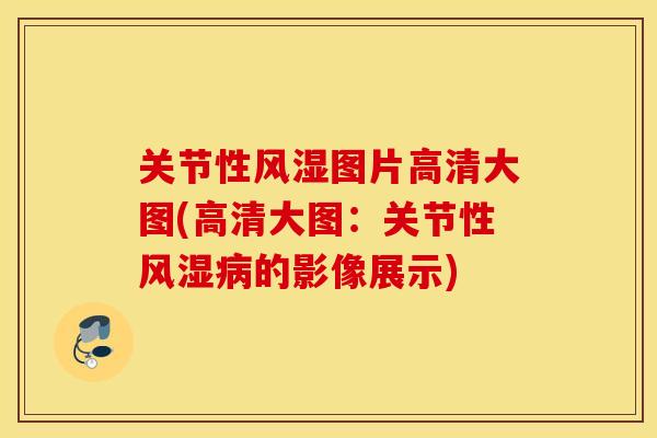 关节性图片高清大图(高清大图:关节性的影像展示) 关节性图片高清大图(高清大图:关节性的影像展示)