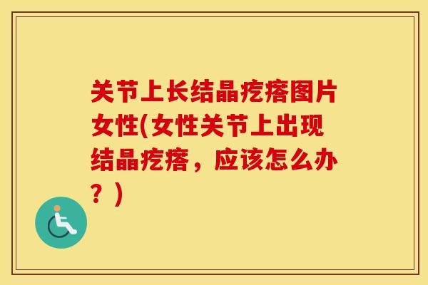 关节上长结晶疙瘩图片女性(女性关节上出现结晶疙瘩，应该怎么办？)