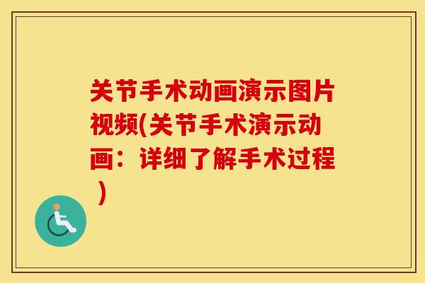 关节手术动画演示图片视频(关节手术演示动画：详细了解手术过程 )