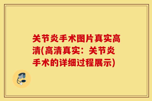手术图片真实高清(高清真实：手术的详细过程展示)