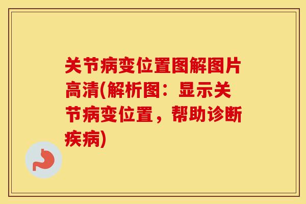 关节变位置图解图片高清(解析图：显示关节变位置，帮助诊断)