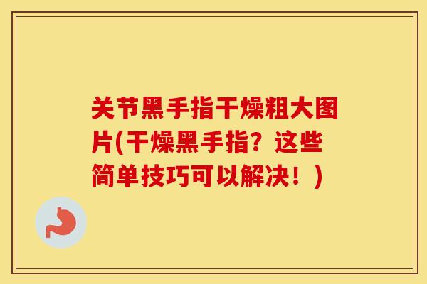 关节黑手指干燥粗大图片(干燥黑手指?这些简单技巧可以解决!) 关节黑手指干燥粗大图片(干燥黑手指?这些简单技巧可以解决!)