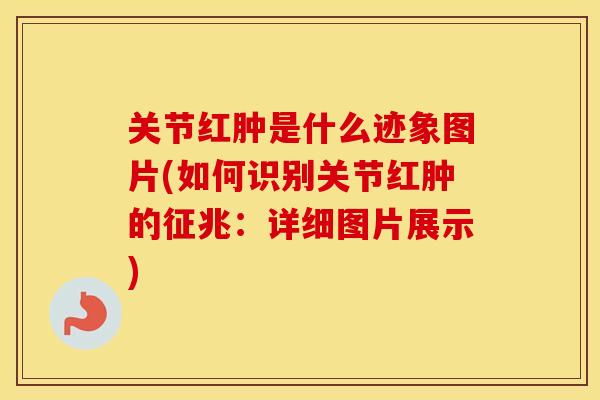 关节红肿是什么迹象图片(如何识别关节红肿的征兆:详细图片展示) 关节红肿是什么迹象图片(如何识别关节红肿的征兆:详细图片展示)