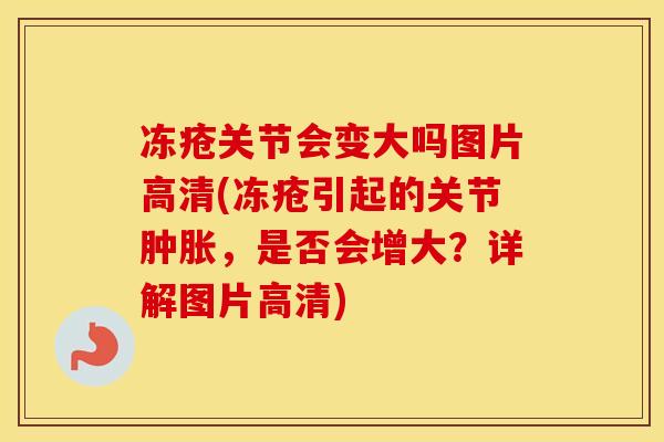 冻疮关节会变大吗图片高清(冻疮引起的关节,是否会增大?详解图片高清) 冻疮关节会变大吗图片高清(冻疮引起的关节,是否会增大?详解图片高清)