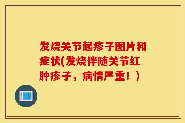 发烧关节起疹子图片和症状(发烧伴随关节红肿疹子,情严重!) 发烧关节起疹子图片和症状(发烧伴随关节红肿疹子,情严重!)
