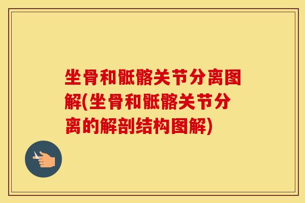 坐骨和骶髂关节分离图解(坐骨和骶髂关节分离的解剖结构图解)