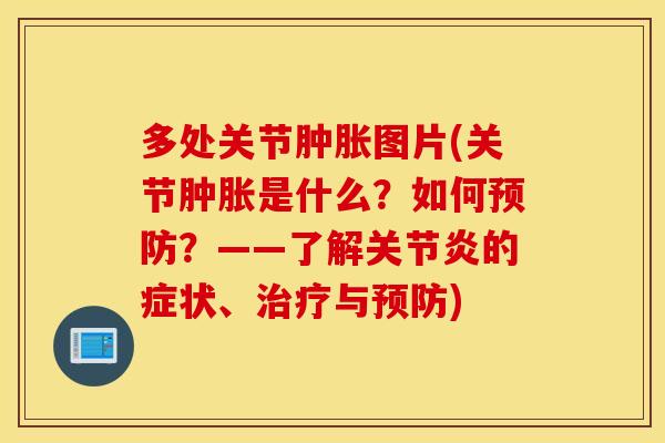 多处关节图片(关节是什么?如何?——了解的症状、与) 多处关节图片(关节是什么?如何?——了解的症状、与)