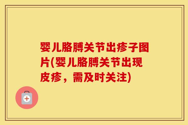 婴儿胳膊关节出疹子图片(婴儿胳膊关节出现皮疹，需及时关注)