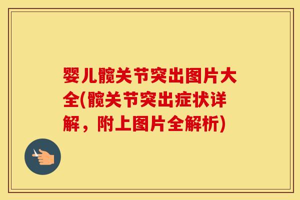 婴儿髋关节突出图片大全(髋关节突出症状详解,附上图片全解析) 婴儿髋关节突出图片大全(髋关节突出症状详解,附上图片全解析)