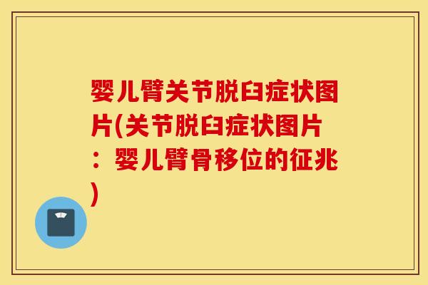 婴儿臂关节脱臼症状图片(关节脱臼症状图片：婴儿臂骨移位的征兆)