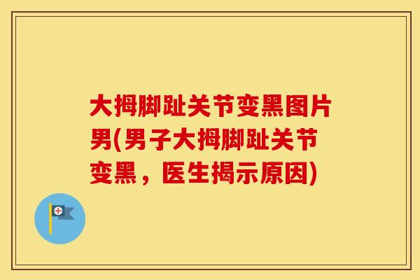 大拇脚趾关节变黑图片男(男子大拇脚趾关节变黑，医生揭示原因)