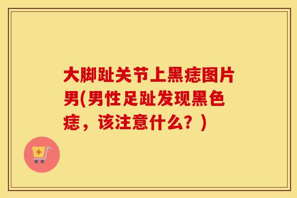 大脚趾关节上黑痣图片男(男性足趾发现黑色痣,该注意什么?) 大脚趾关节上黑痣图片男(男性足趾发现黑色痣,该注意什么?)