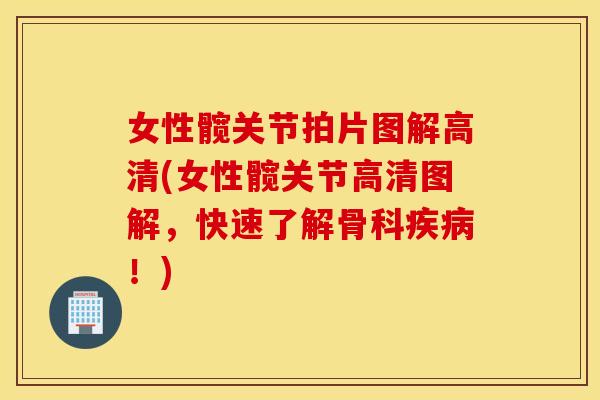 女性髋关节拍片图解高清(女性髋关节高清图解，快速了解骨科！)