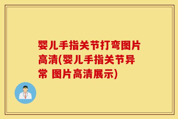 婴儿手指关节打弯图片高清(婴儿手指关节异常 图片高清展示) 婴儿手指关节打弯图片高清(婴儿手指关节异常 图片高清展示)