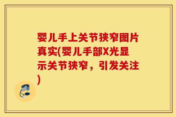 婴儿手上关节狭窄图片真实(婴儿手部X光显示关节狭窄,引发关注) 婴儿手上关节狭窄图片真实(婴儿手部X光显示关节狭窄,引发关注)